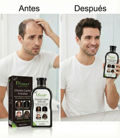 Shampoo Anticaída + ¡Envío Gratis! Recupera la Fuerza de tu Cabello